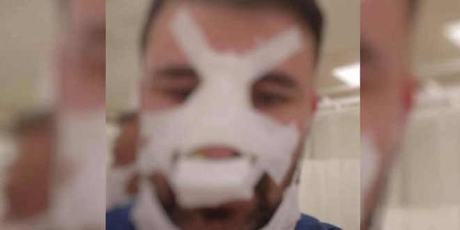Sağlıkçının burnunu kıran zanlı: Ben vurmadım, o bana yumruk attı