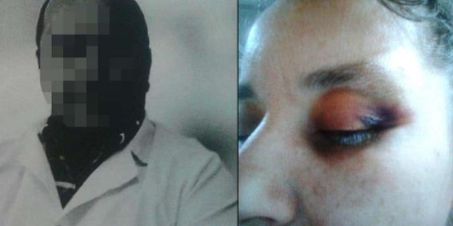 Doktor a�abeyi taraf�ndan darp edildi