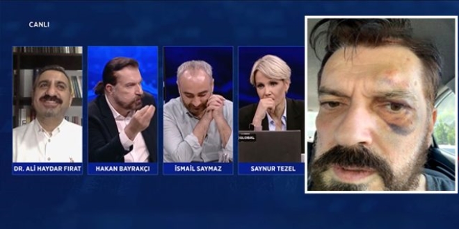 1 yıl sonra gelen itiraf: Teke tek çağırdım, 5 kişi gelip saldırdılar