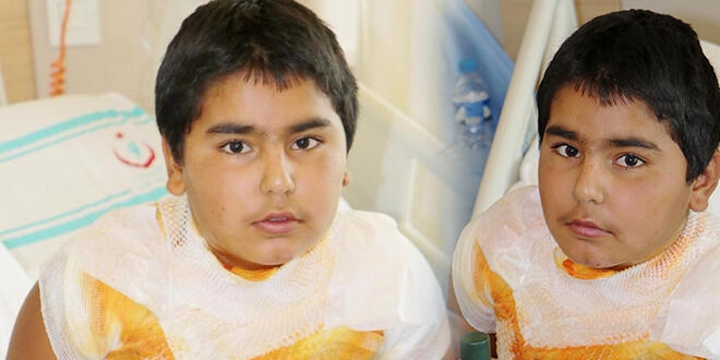 12 yaşındaki Orhan: Kolonyanın yandığını yanarak öğrendim