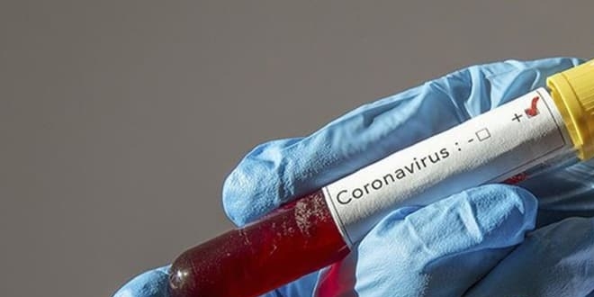'Tayinle gelen memurda koronavirs kt' haberine aklama