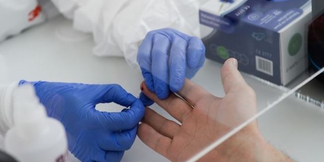 İngiltere'de hızlı sonuç veren Kovid-19 antikor testi geliştirildi