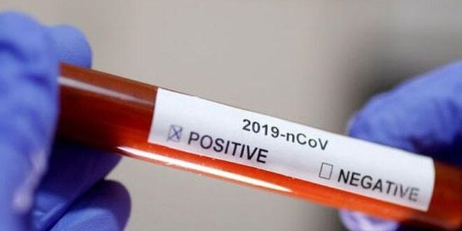 T�rkiye'nin koronavir�sle m�cadelesinde son 24 saatte ya�ananlar