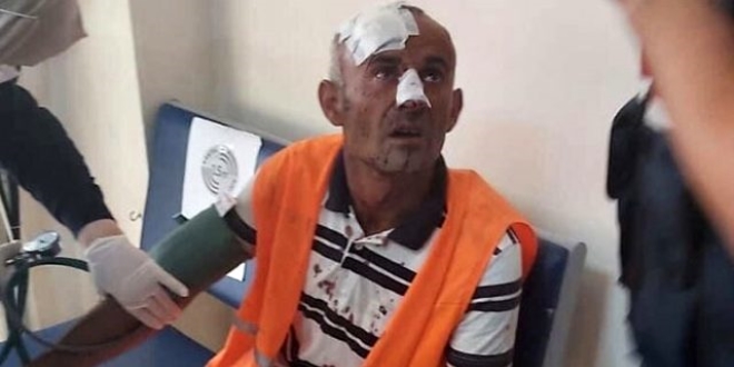 Temizlik görevlisi, uyardığı grup tarafından darp edildi
