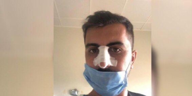 Bakan Koca'dan saldırıya uğrayan sağlık çalışanına destek