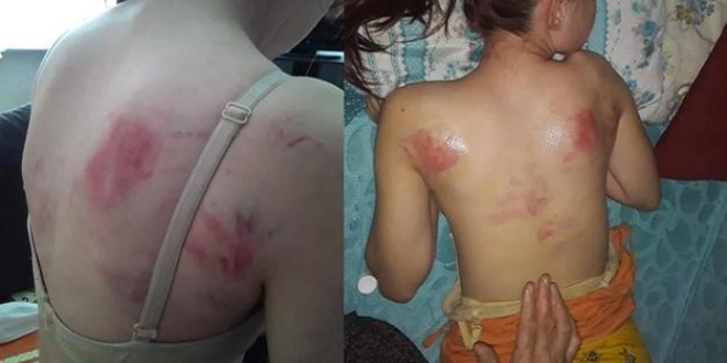 Kızını İngiliz anahtarı ile döven baba tutuklandı