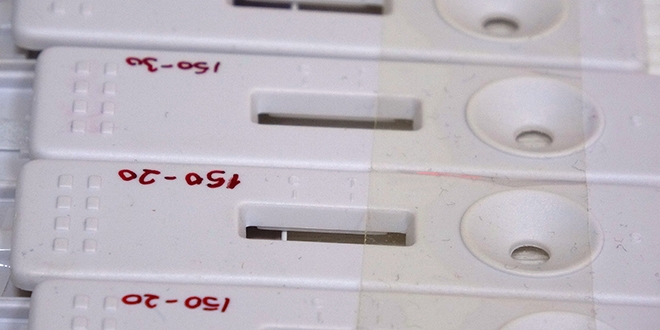 Dünyada bir ilk: Çift antikorlu tanı kiti ÇOMÜ'de geliştirildi