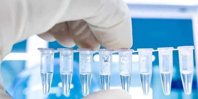 'Test sonucu karıştı' iddialarına Sağlık Müdürlüğünden açıklama