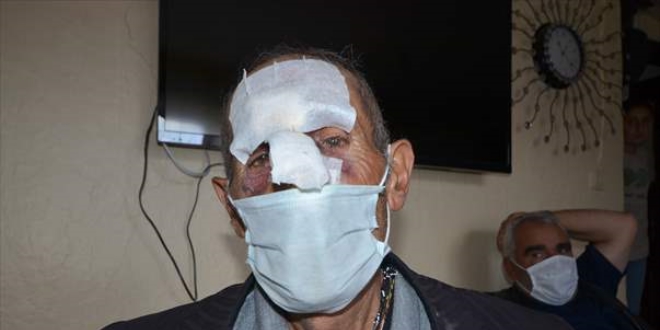 Kars'ta ayı saldırısına uğrayan kişi yaralandı