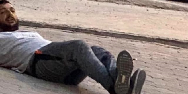 Silahla yaraladığı akrabasının fotoğrafını sosyal medyadan paylaştı