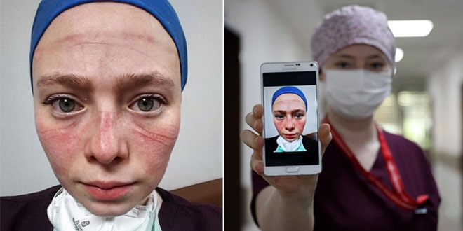 Fedakarlığın fotoğrafı!