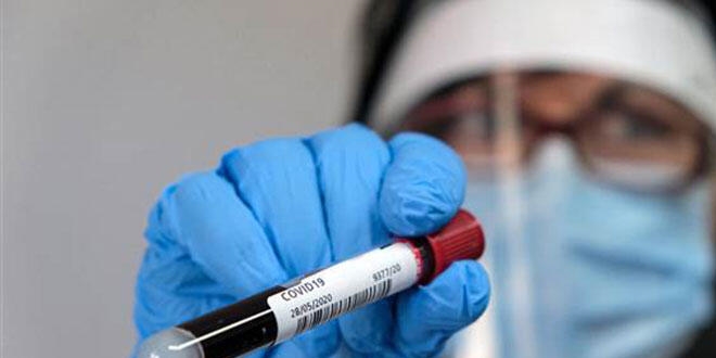 DSÖ'den 'koronavirüs testi' açıklaması