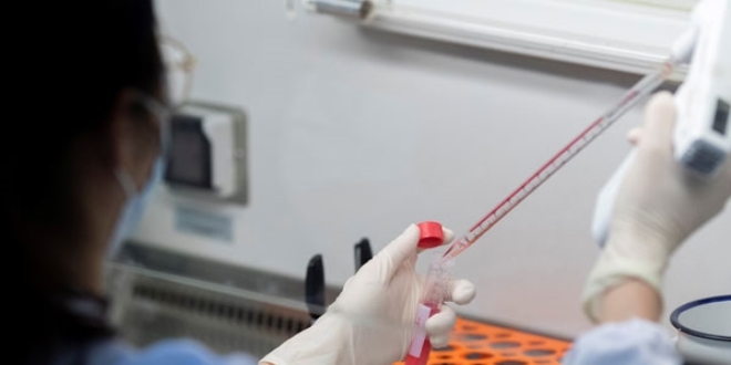 DSÖ düşük gelirli ülkelere Covid-19 testi gönderecek