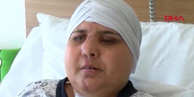 Kazada ikiye ayrılan yüzü, 10 saatlik ameliyatla birleştirildi