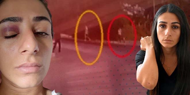 Sokak ortasında tacize karşı koyunca tekme tokat dövüldü