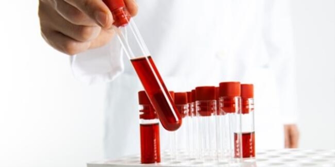 drarda grlen kana dikkat