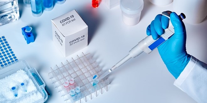 DSÖ'den Covid19 ile mücadelede Türkiye'ye övgü