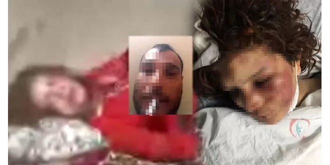 Eşine günlerce işkence yapan şüpheli tutuklandı