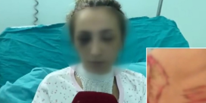 Eşine ısıtılmış bıçakla işkence yapan saldırgan aranıyor
