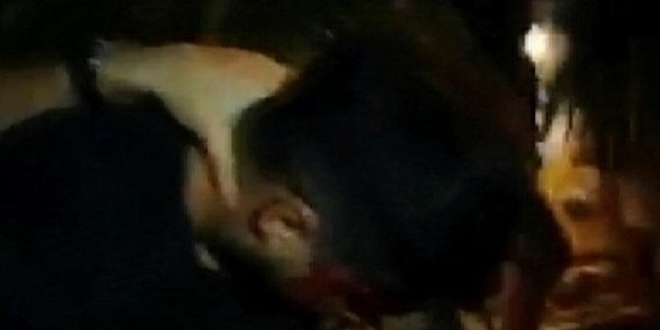 Sigara için çakmağını çaktı 'kundakçı' diye dayak yedi