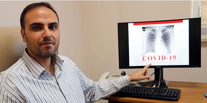 Yapay zekayla r�ntgen filmlerinden koronavir�s te�hisinde b�y�k ba�ar�