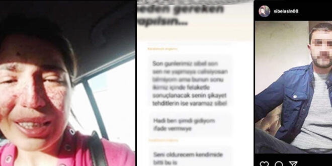 Boşandığı eşinden şiddet gören Sibel, sosyal medyadan yardım istedi
