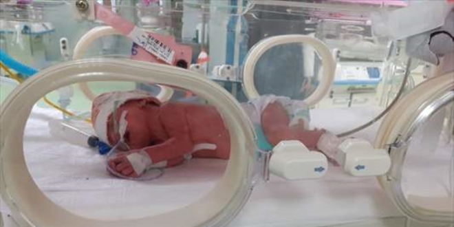 Çift rahimli kadın, her bir rahminden birer bebek dünyaya getirdi