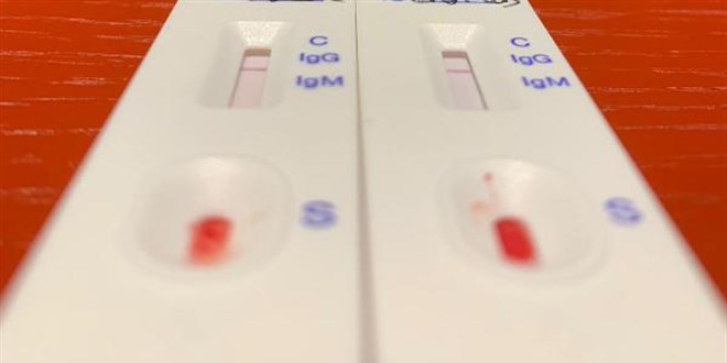 Uzmanlardan evde hızlı Kovid testi yapanlara uyarı