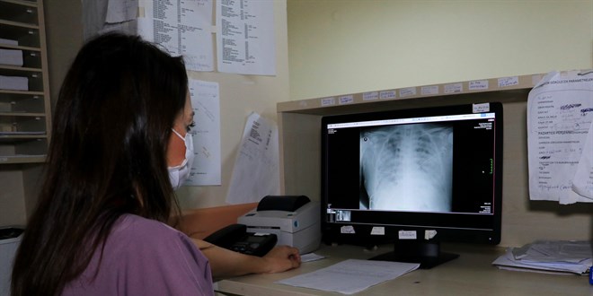 Koronalı hastaların akciğer röntgenleri korkuttu