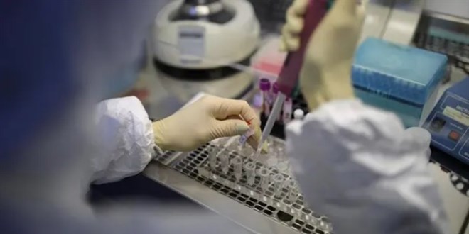 ASELSAN geliştirdi: Virüs tanısında yeni dönem