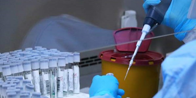 Samsun'da koronavirs test cihaz ve kapasitesi artrld