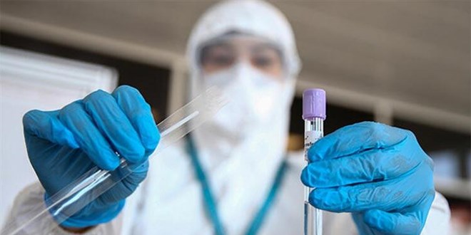 Türk bilim insanları yaptı! 15 saniyede korona teşhisi