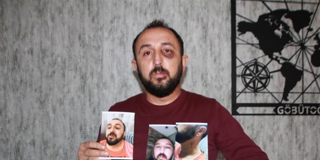 Emlakçıyı darp eden okul müdürüne soruşturma açıldı