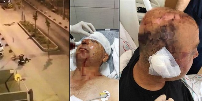 Polisin kafasını telsizle ezmişti! Ağır Cezada yargılanacak