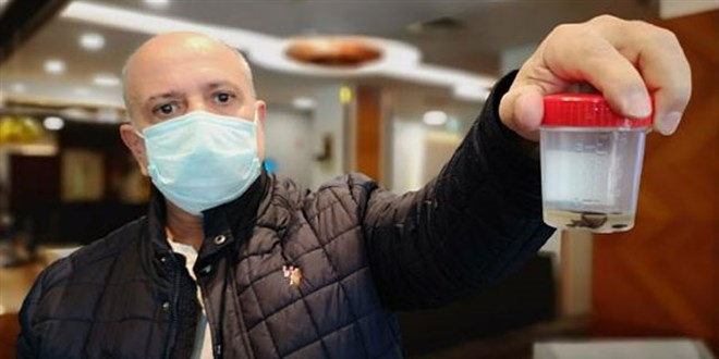 Kanser sandılar, akciğerinden 32 yıl sonra çam fıstığı çıktı