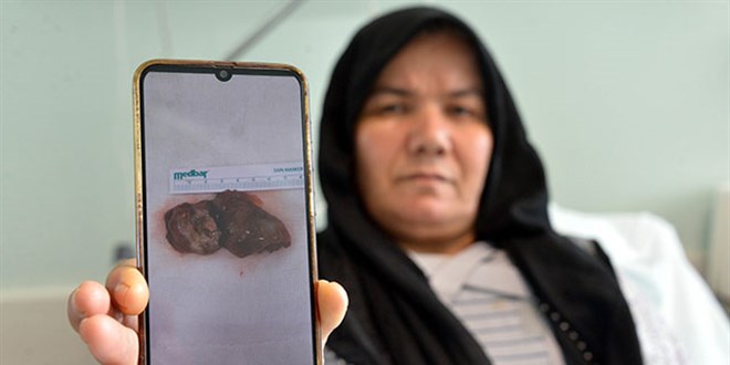 Kalbinden 7 santimetrelik kitle çıkarıldı