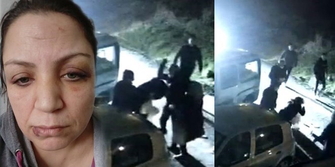 Kirayı geciktirdiği için darbedilen kadın şikayetçi oldu