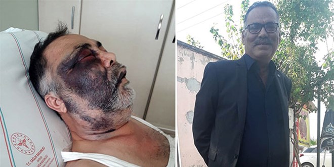 Antalya Başsavcılığı: Engelli kişiye saldıran baba oğul tutuklandı