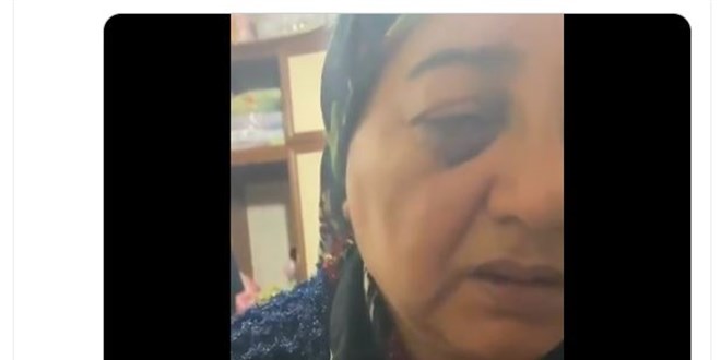 Sosyal medyadan ihbar edilen zanlı, eşini darbettiği iddiasıyla tutuklandı