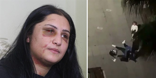 Samsun'da eski eşinin dövdüğü kadın: Şiddet sessiz kalındıkça çoğalıyor