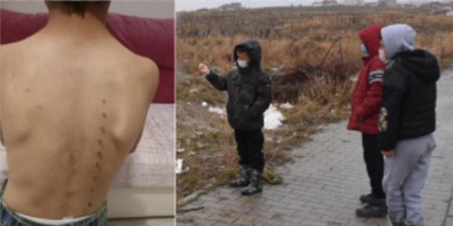 3 çocuğu tırmıkla yaralamıştı! O hemşire tutuklandı