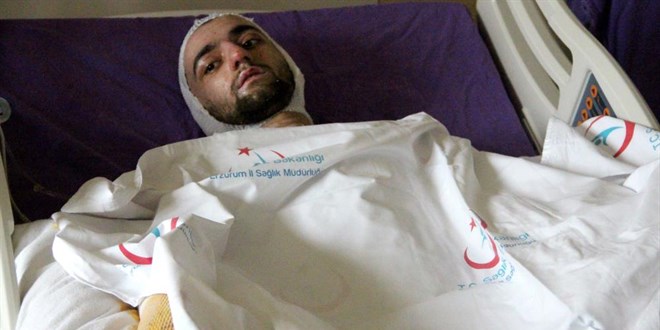 Banyo yapmak iin sobaya benzin dkt, feci ekilde yand