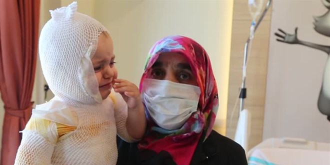 1 yaşındaki bebeğin üzerine kaynar süt döküldü