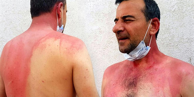 Sigara dumanı nedeniyle tartıştığı komşusunun üzerine kaynar su döktü