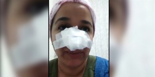 Uzman avu'un darp olaynda Basavclk: Herhangi bir kemik kr yok