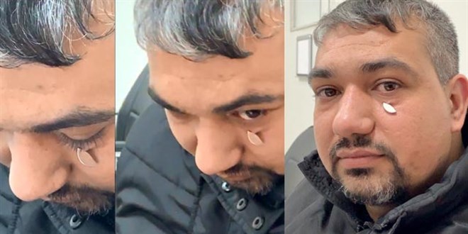 Göz altındaki metal parçayı 3 yıl sonra mıknatısla fark etti