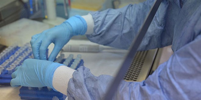 Temaslılara test uyarısı: En erken 3 gün sonra yaptırın