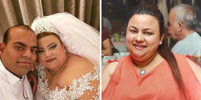 Mide ameliyatı sonrası ölümde, doktorun 6 yıl hapsi isteniyor