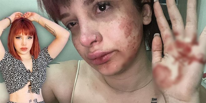 Fenomen Başak Ermiş'e oyuncu Can Topçu'dan dayak: Ölmek istemiyorum