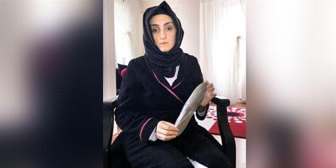 Ameliyat sonrası hayatının şokunu yaşadı! Karnında mala unutuldu